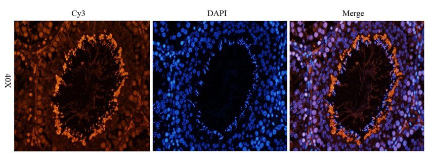 APOBEC3B Rabbit Polyclonal Antibody