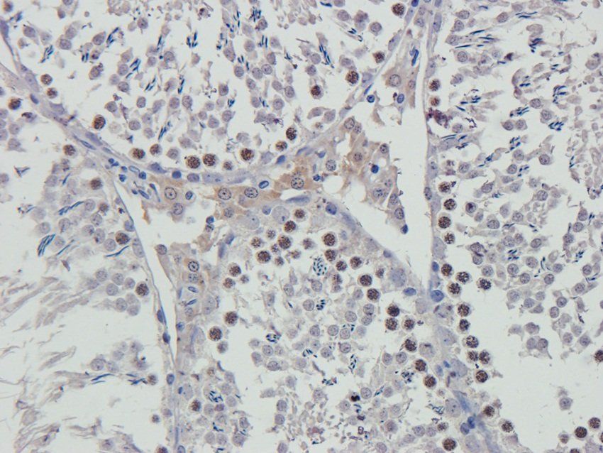 APOBEC3B Rabbit Polyclonal Antibody