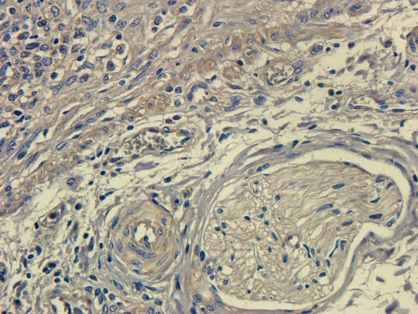 ApoE1 Mouse Monoclonal Antibody