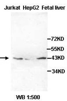 APOL1 Rabbit Polyclonal Antibody