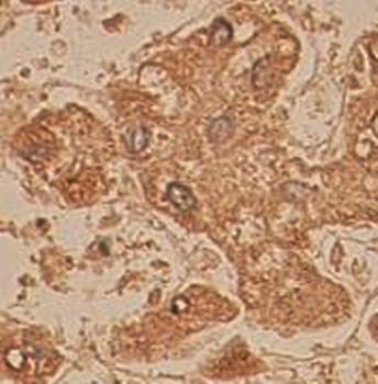 APOL1 Rabbit Polyclonal Antibody