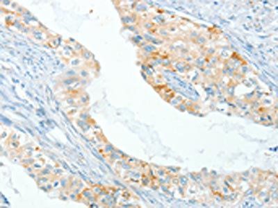 APOL2 Antibody
