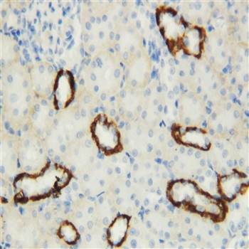 Aquaporin 3/AQP3 Rabbit Polyclonal Antibody