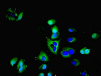 AQP3 Antibody