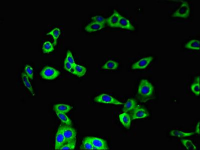 AQP3 Antibody