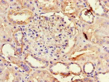 AQP3 Antibody