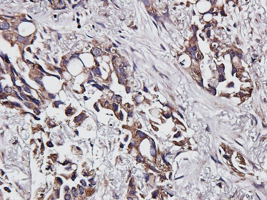 Aquaporin 5 Rabbit Polyclonal Antibody