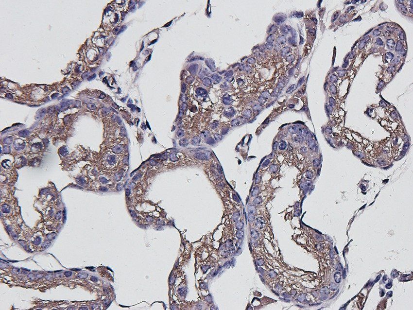 Aquaporin 5 Rabbit Polyclonal Antibody