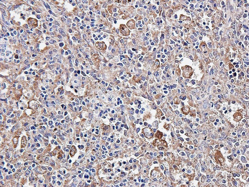 Aquaporin 5 Rabbit Polyclonal Antibody