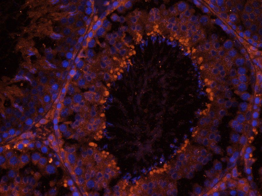 Aquaporin 7 antibody
