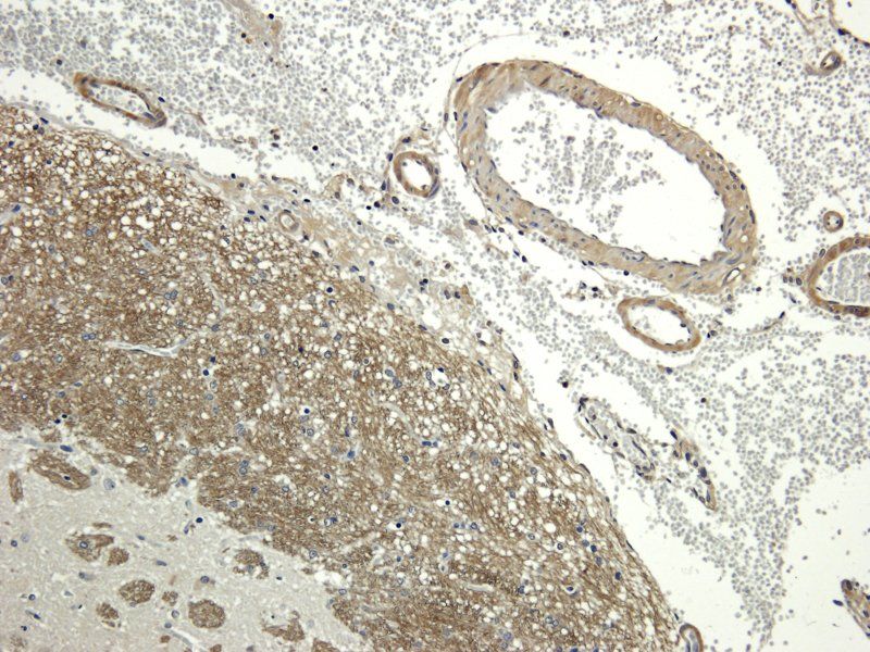 Aquaporin 4 antibody