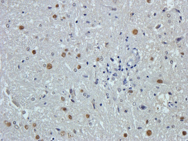 Aquaporin 4 Rabbit Polyclonal Antibody