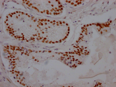 AR Antibody