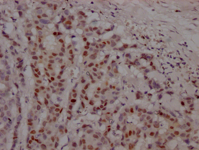 AR Antibody