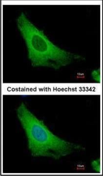 ARF3 Rabbit Polyclonal Antibody