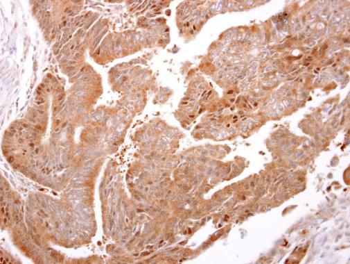 ARF3 Rabbit Polyclonal Antibody