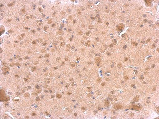 ARF3 Rabbit Polyclonal Antibody