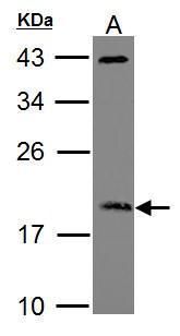 ARF3 Rabbit Polyclonal Antibody