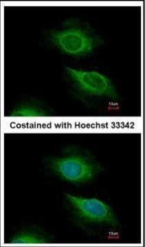 ARF5 Rabbit Polyclonal Antibody