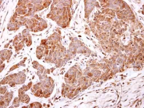 ARF5 Rabbit Polyclonal Antibody