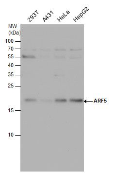 ARF5 Rabbit Polyclonal Antibody