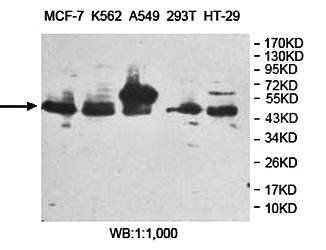 ARFGAP1 Rabbit Polyclonal Antibody