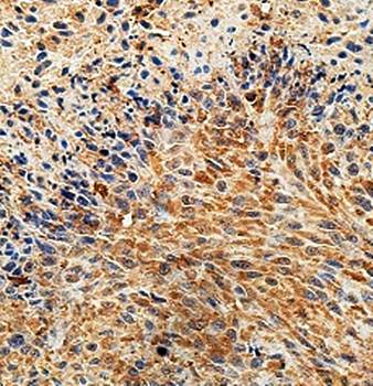 ARFGAP1 Rabbit Polyclonal Antibody