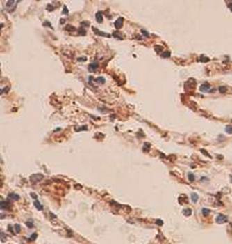 ARFIP2 Rabbit Polyclonal Antibody