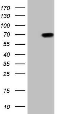 ASL Antibody