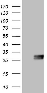 ASL Antibody