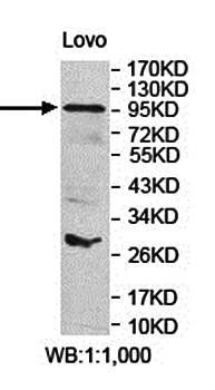 ARHGAP17 Rabbit Polyclonal Antibody