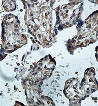 ARHGAP17 Rabbit Polyclonal Antibody