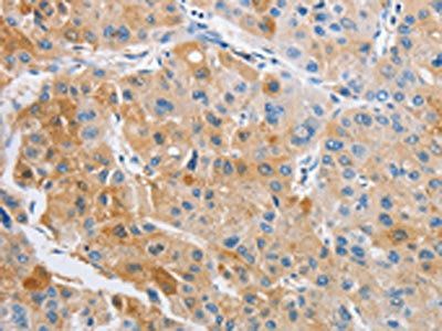 ARHGAP5 Antibody