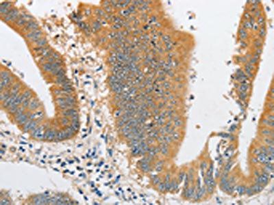 ARHGAP5 Antibody