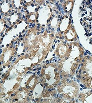 ARHGAP5 Rabbit Polyclonal Antibody
