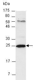 ARHGDIB (N1) Antibody, Rabbit Polyclonal