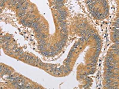 ARHGEF1 Antibody