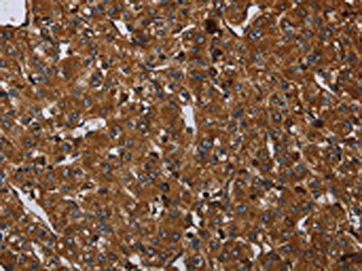 ARHGEF12 Antibody