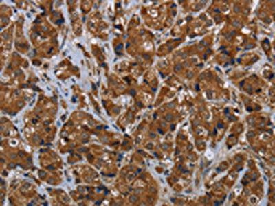 ARHGEF12 Antibody