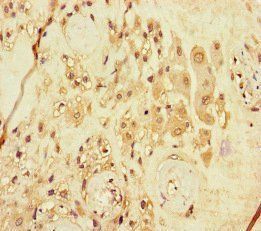 ARHGEF5 Antibody