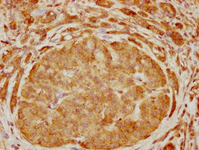 ARHGEF6 Antibody