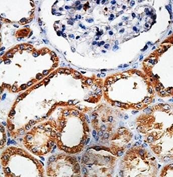 ARL1 Rabbit Polyclonal Antibody