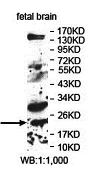 ARL1 Rabbit Polyclonal Antibody