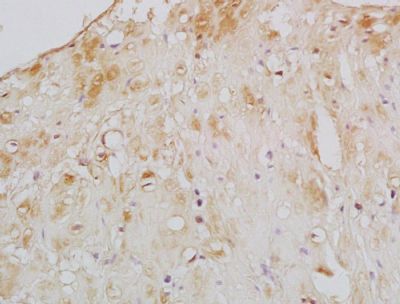 ARPC2 Rabbit Polyclonal Antibody