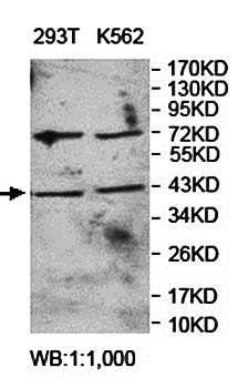 ARPM1 Rabbit Polyclonal Antibody