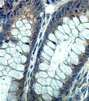 ARPM1 Rabbit Polyclonal Antibody