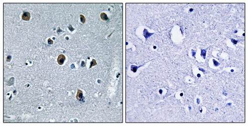 Collagen XX α1 Antibody