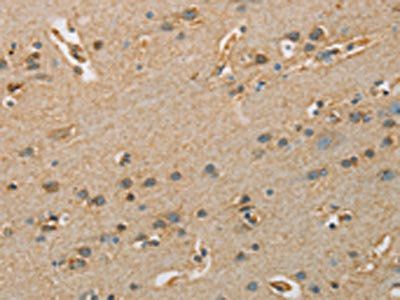 ARSA Antibody