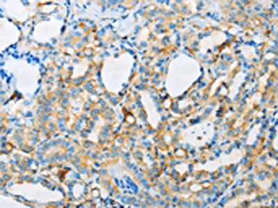 ARSA Antibody