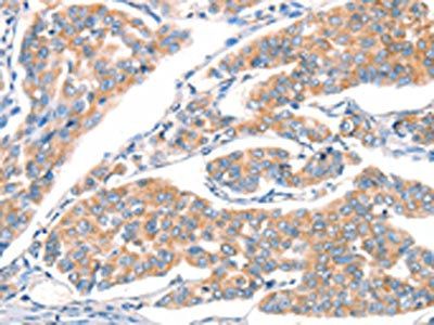 ART4 Antibody